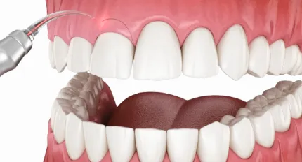 Gum Disease Treatment